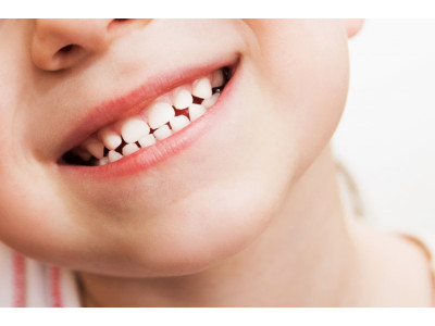 Переваги використання дитячих коронок для відновлення молочних зубів